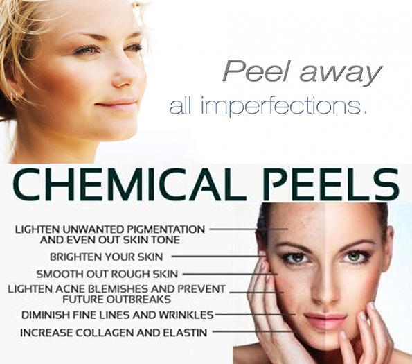 Chemical Peels | Products & Services | , Melkbosstrand, , Cape Town ...